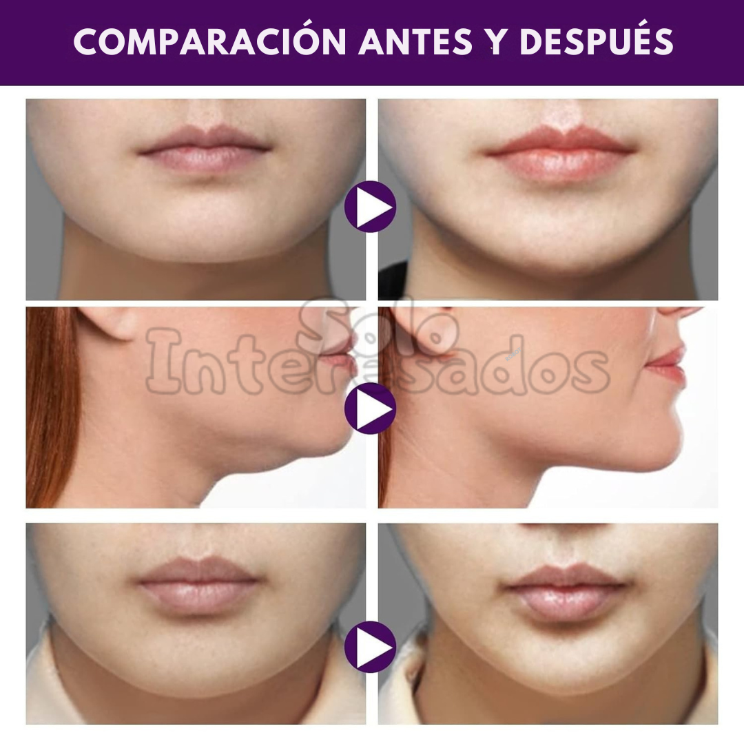 Cinta Lifting Bella (120 unidades)