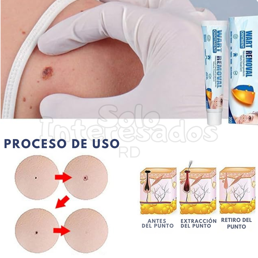 Adiós Verrugas 20g