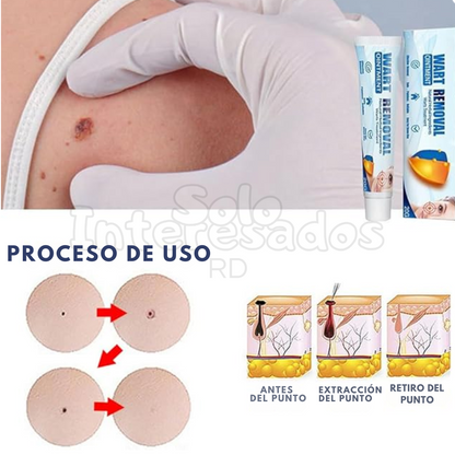 Adiós Verrugas 20g