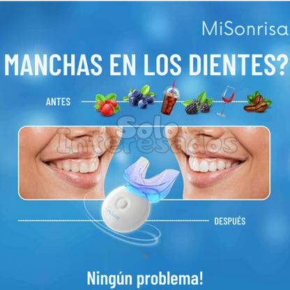 MiSonrisa (Kit de Blanqueamiento Dental)
