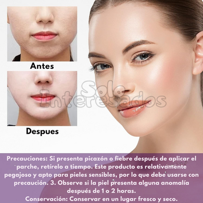 Cinta Lifting Bella (120 unidades)