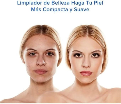 Limpia Poros (Removedor de puntos negros)