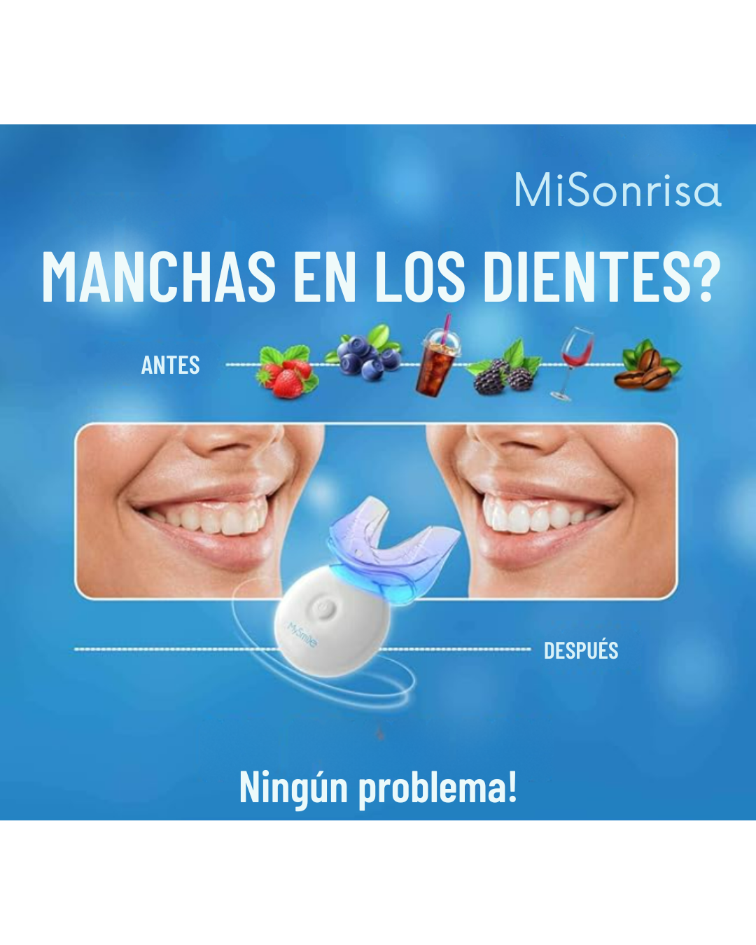 ✨ MiSonrisa - Kit de Blanqueamiento Dental de Lujo ✨